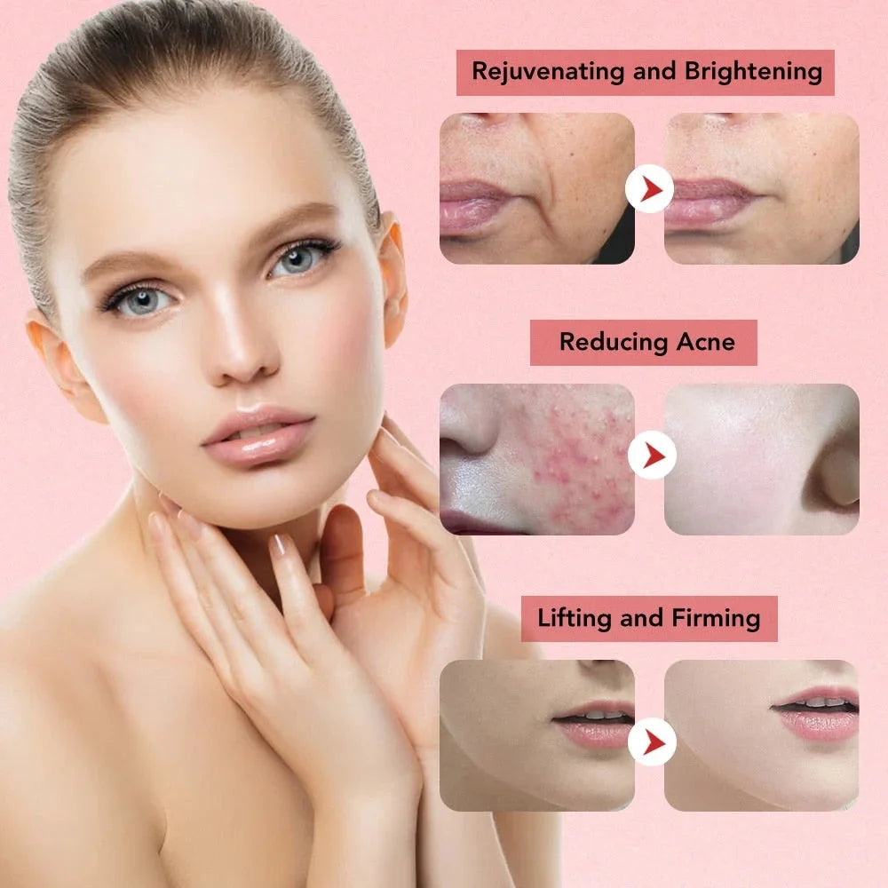 7 in 1 Face Lift Device -  Cleansing Rejuvenation Rose Cosmetics